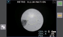 Látásvizsgálat Balmazújvárosban